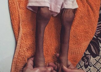 Unicef: 2018 Tahun Paling Mematikan Bagi Anak-Anak Suriah