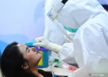Guru Besar Kedokteran UI: Kalau Tes PCR Murah Lebih Mudah Mengendalikan Pandemi