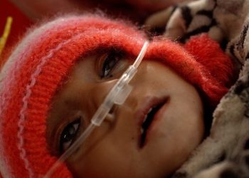 Setiap Detik Anak Afghanistan Berjibaku Melawan Kelaparan
